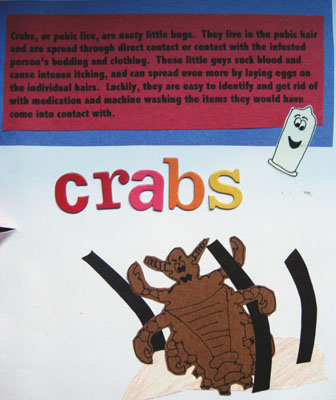 Crabs