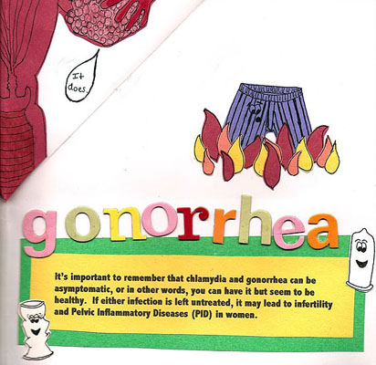Gonorrhea
